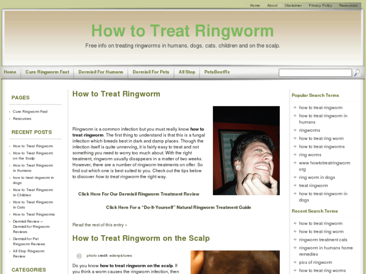 www.howtotreatringworm.org