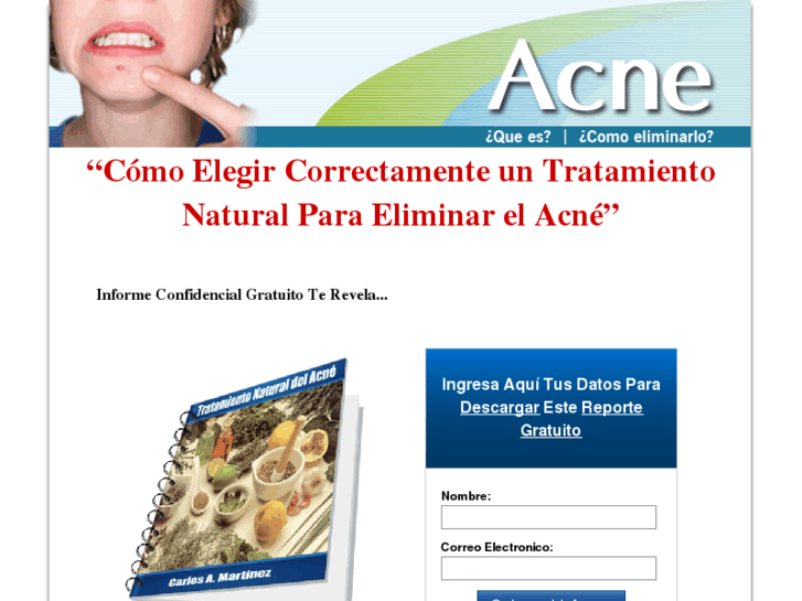 www.eliminar-el-acne.com