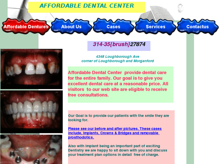 www.stlouisdentures.com