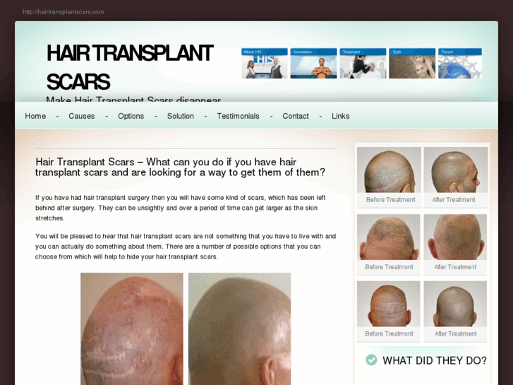 www.hairtransplantscars.com