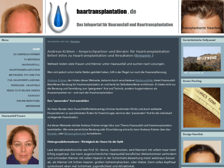 www.haartransplantation.de