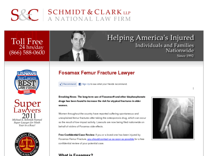 www.fosamaxfemurfracturelawyer.org