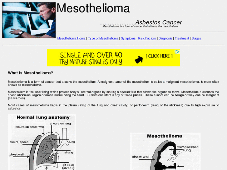 www.asbestos-mesothelioma-cancer-info.com