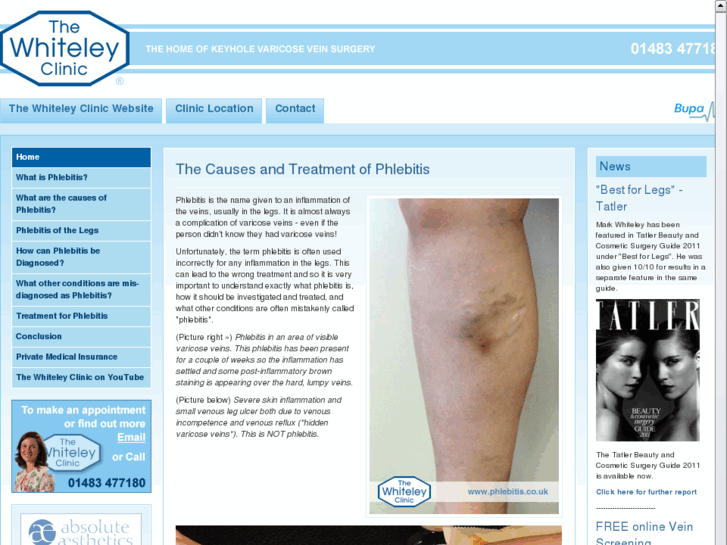 www.phlebitis.co.uk