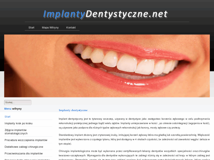 www.implantydentystyczne.net