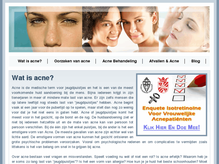 www.acne-info.nl