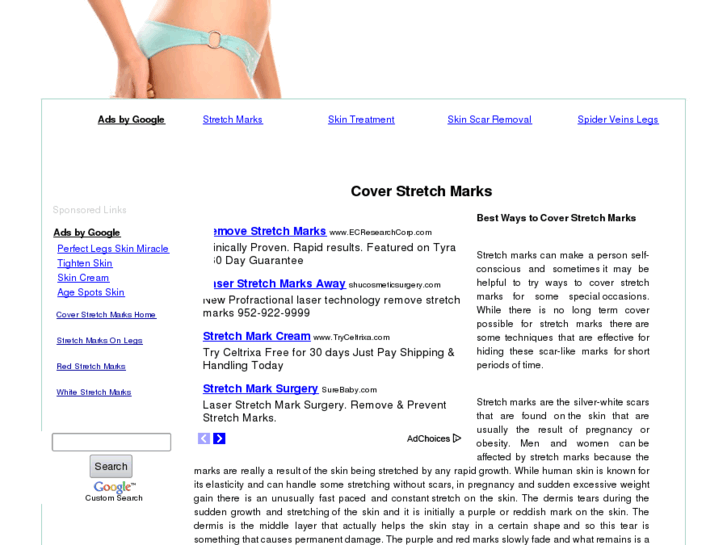 www.coverstretchmarks.net