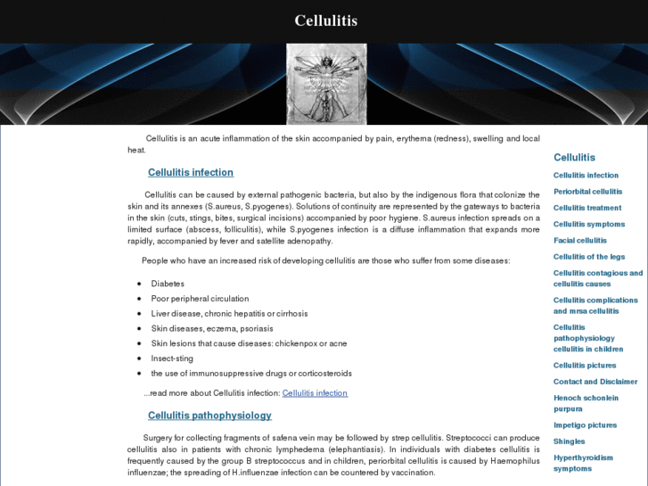 www.periorbitalcellulitis.org