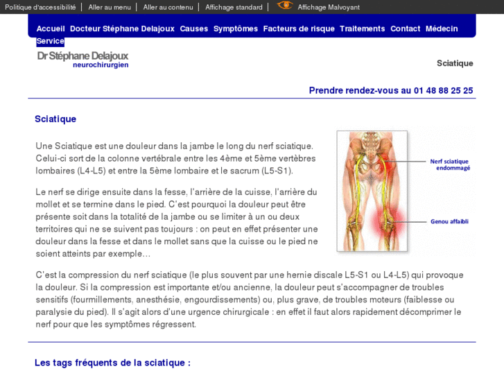 www.la-sciatique.com