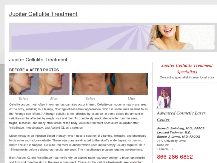 www.jupitercellulitetreatment.com