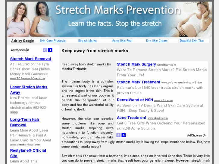 www.stretch-marks-prevention.com