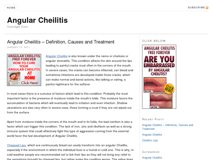 www.angularcheilitis.net