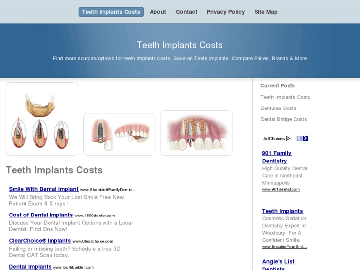 www.teethimplantscosts.com