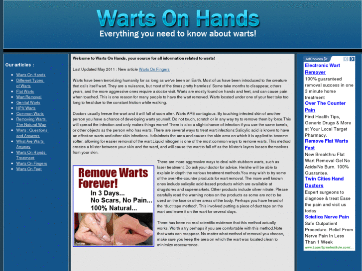 www.wartsonhands.com