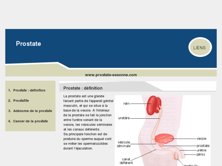 www.prostate-essonne.com