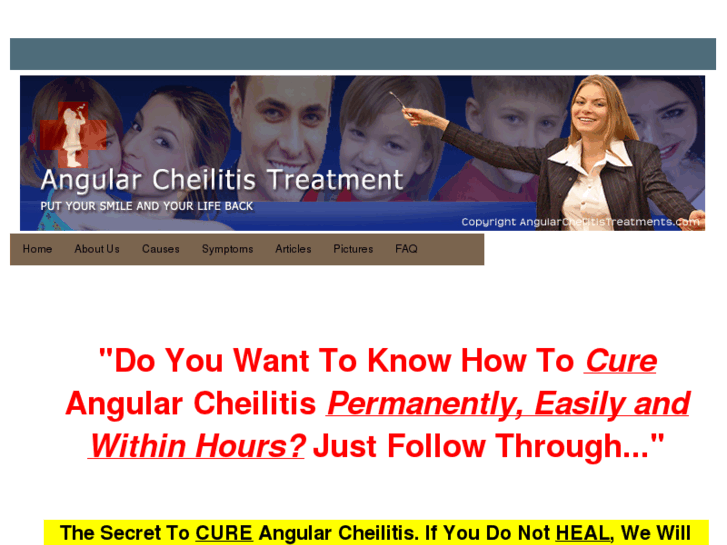 www.angularcheilitistreatments.com