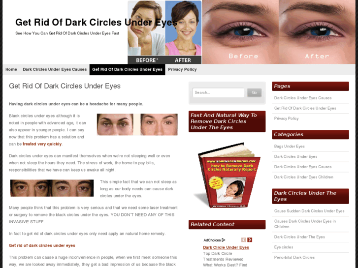 www.getridofdarkcirclesundereyes.net