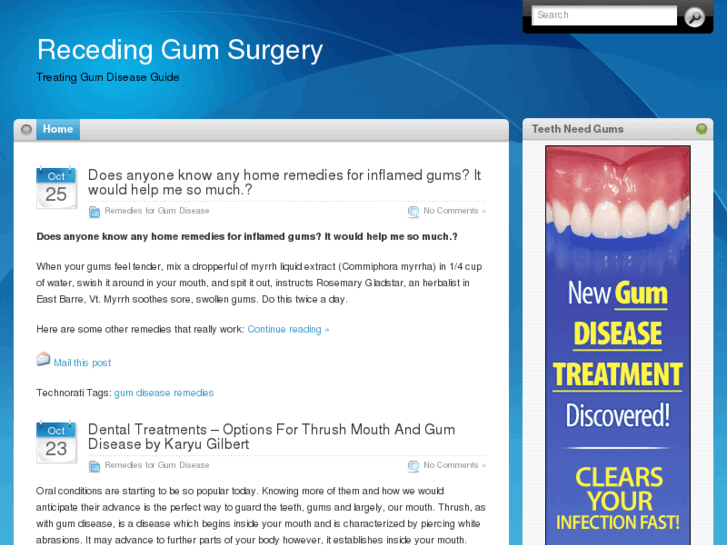 www.recedinggumsurgery.com