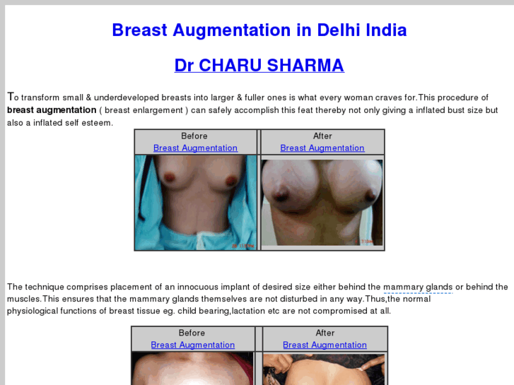 www.breastaugmentation-delhi.com