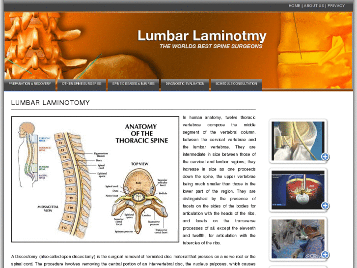 www.lumbarlaminotomy.info