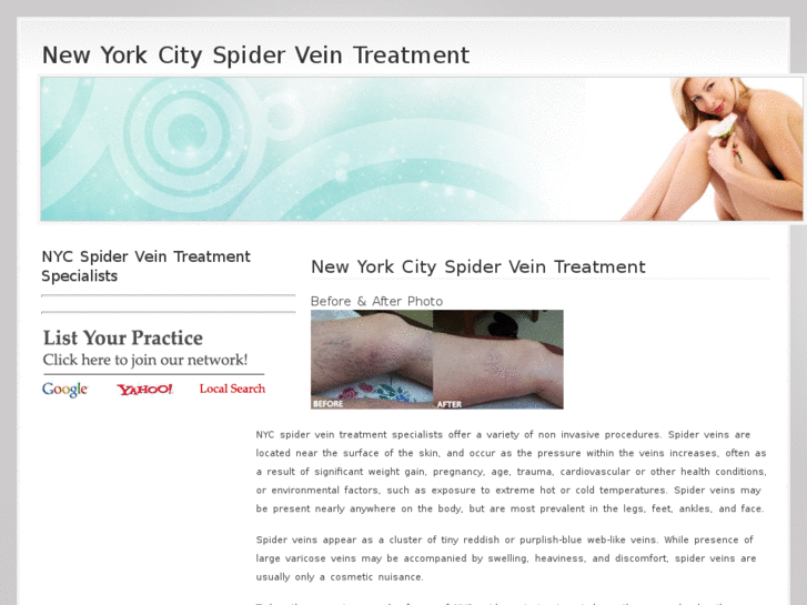 www.newyorkspiderveintreatment.com