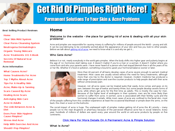 www.justgetridofpimples.com