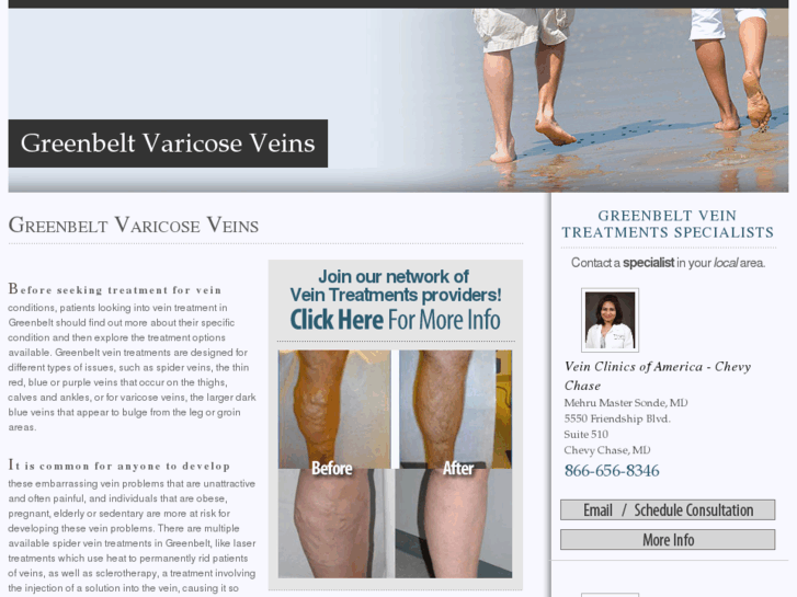 www.greenbeltvaricoseveins.com