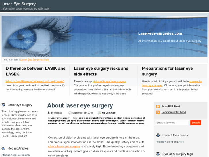 www.laser-eye-surgeries.com