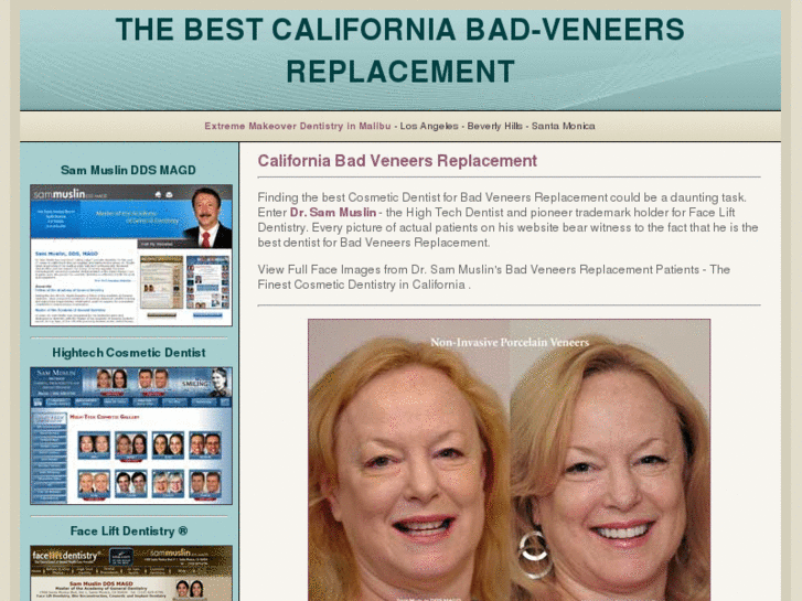 www.californiabadporcelainveneers.com