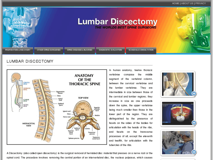 www.lumbardiscectomy.info