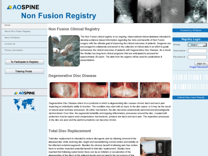 www.nonfusionregistry.org