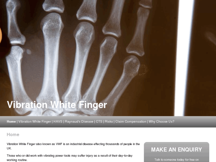 www.white-finger.com