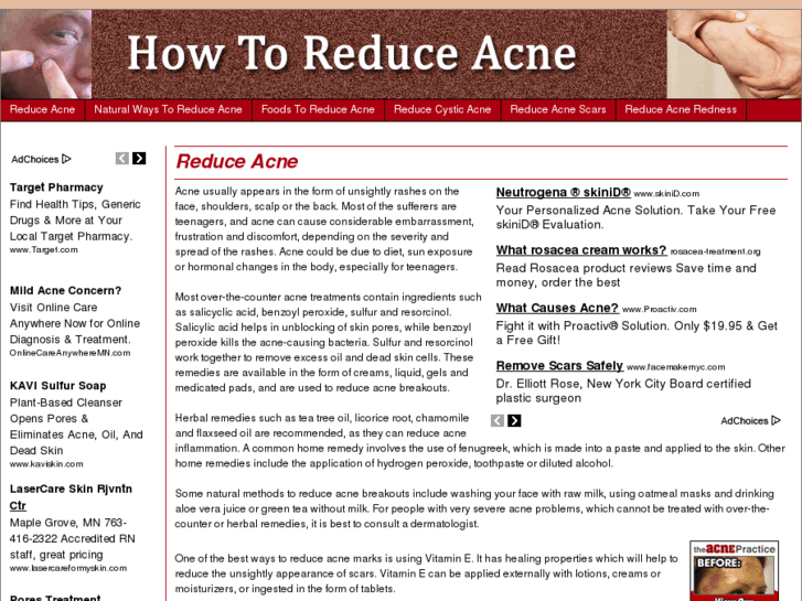 www.howtoreduceacne.net