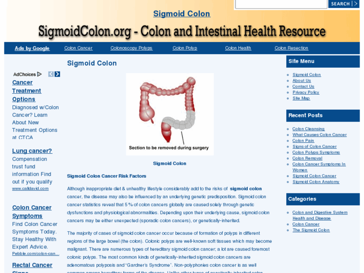 www.sigmoidcolon.org