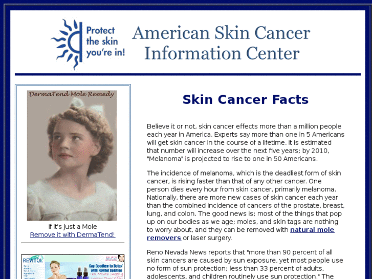 www.skin-cancer-mole-picture.com