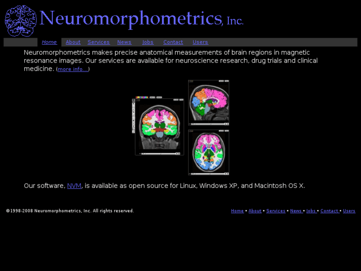 www.neuromorphometrics.com