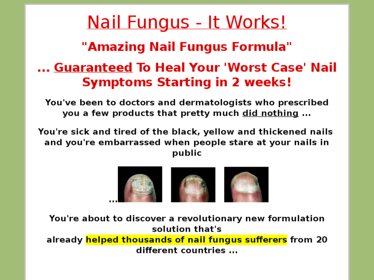 www.nail-fungus-md.com