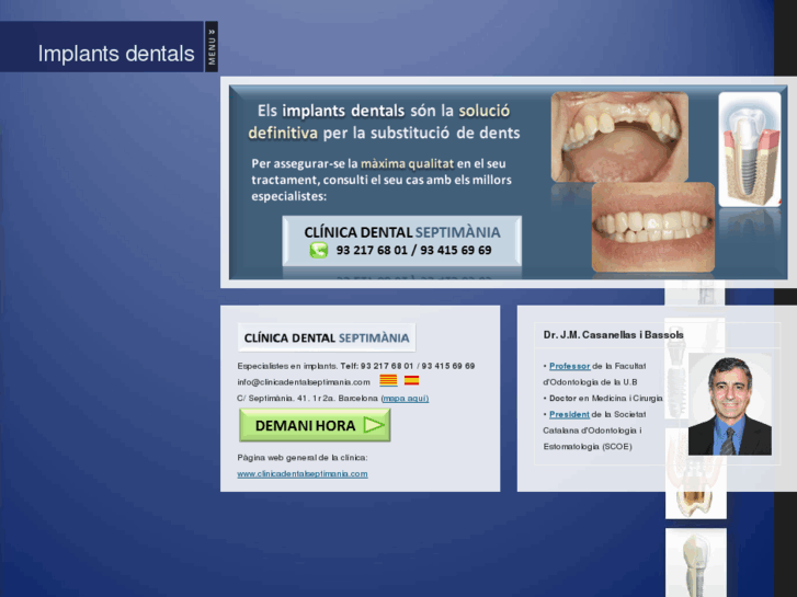 www.implants-dentals.com