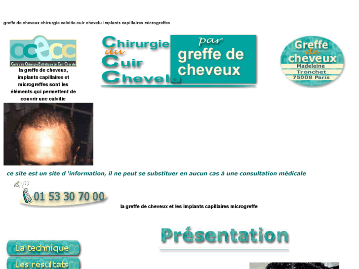 www.greffe-cheveux.com