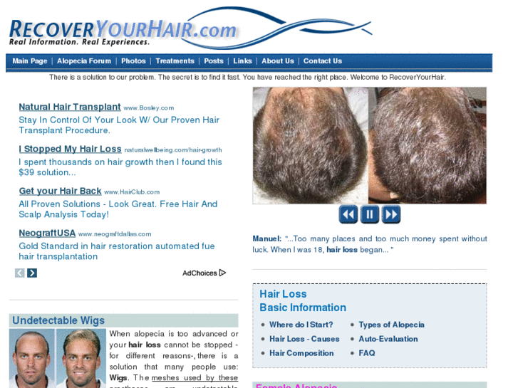 www.recoveryourhair.com