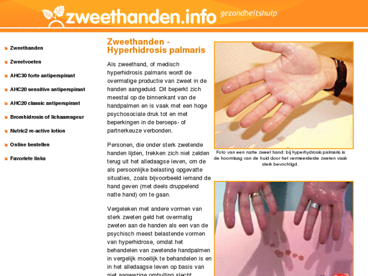 www.zweethanden-zweetvoeten.info