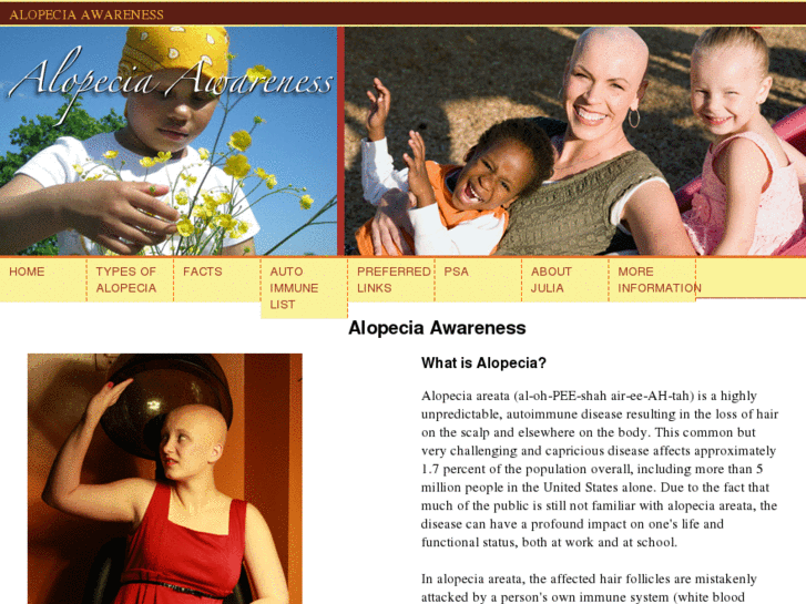 www.alopeciaawareness.com