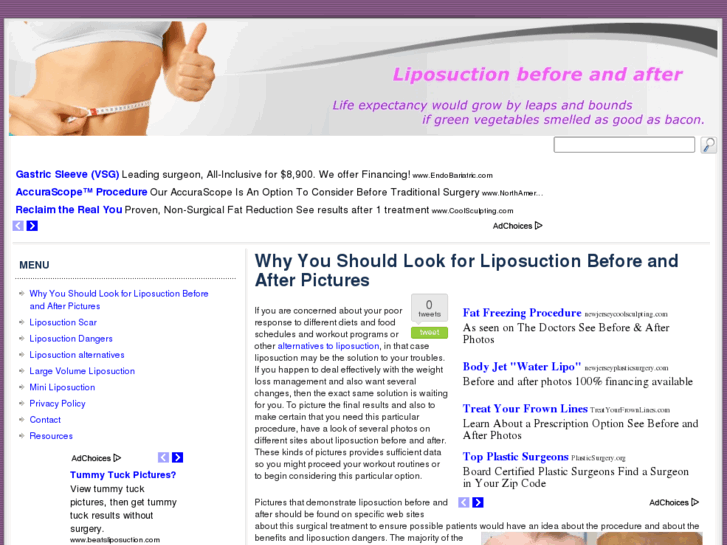 www.liposuction-beforeandafter.com