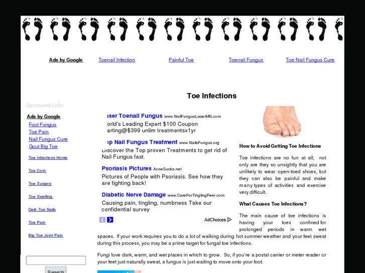 www.toeinfections.net