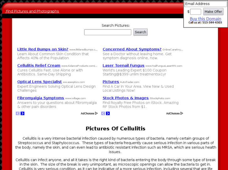 www.picturesofcellulitis.com