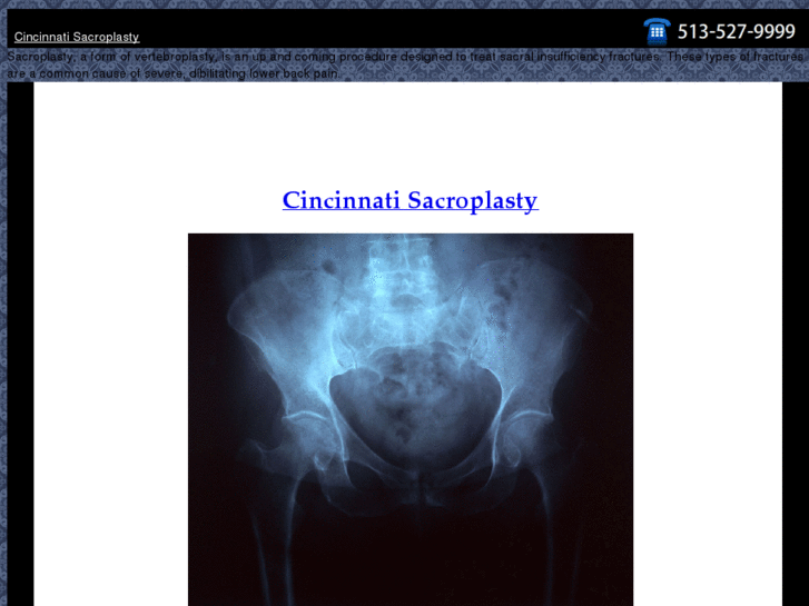 www.cincinnatisacroplasty.com