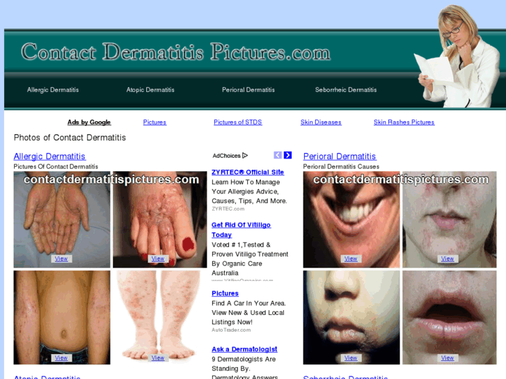 www.contactdermatitispictures.com