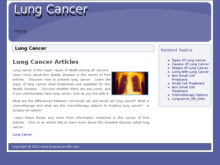 www.lungcancer-life.com