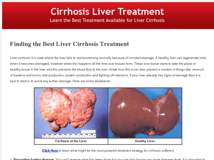 www.cirrhosislivertreatment.com