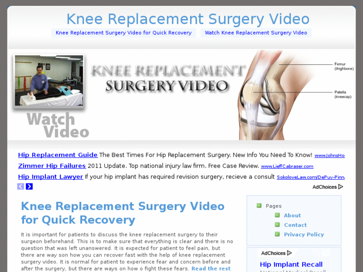 www.kneereplacementsurgeryvideo.net